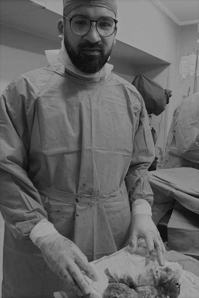 عملية استئصال ورم كبير من المبيض