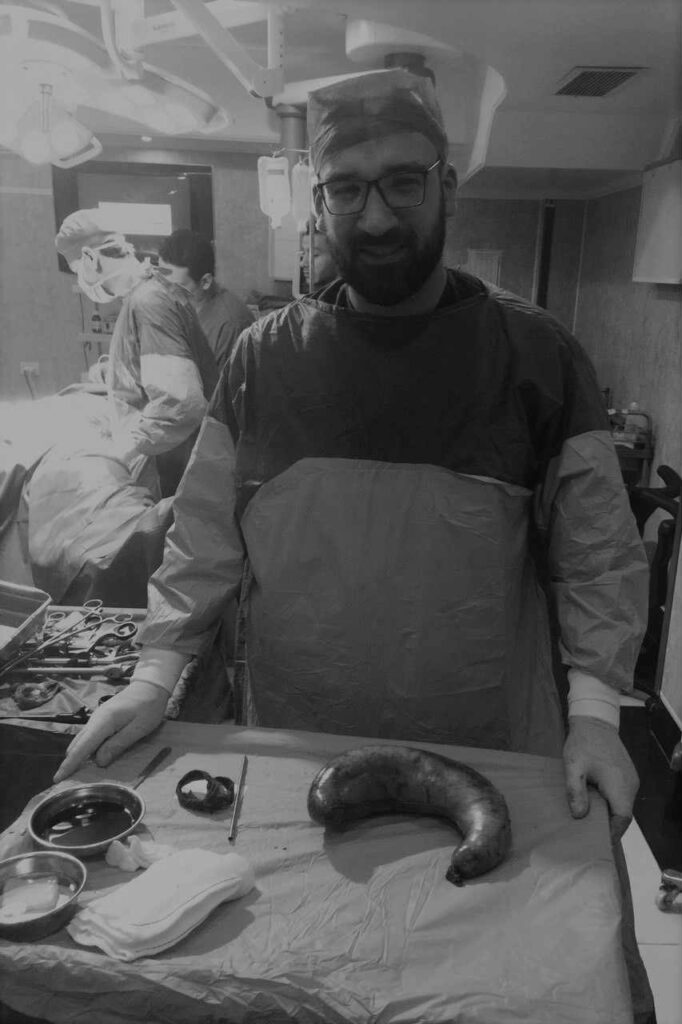 عملية تكميم معدة بالمنظار