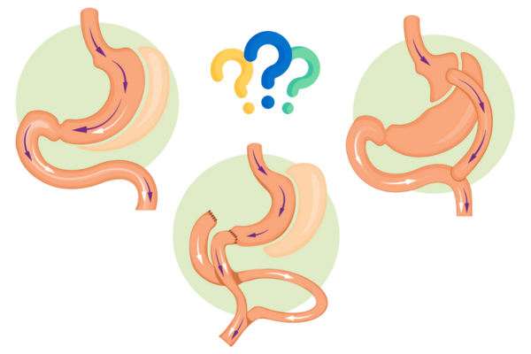 عن جراحات السمنة